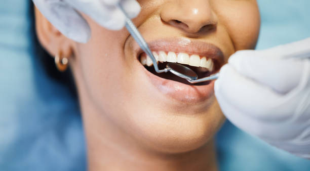 Best Lost Filling or Crown Replacement in Strathmore, NJ